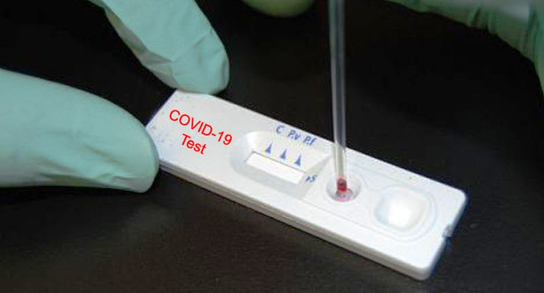 र्‍यापिड टेस्ट गर्दा मुगुमा १ जनामा कोरोना पोजिटिभ