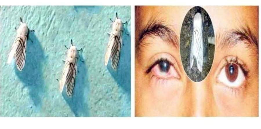 गुल्मीमा फैलिएको डरलाग्दो रोग सापु के हो ?