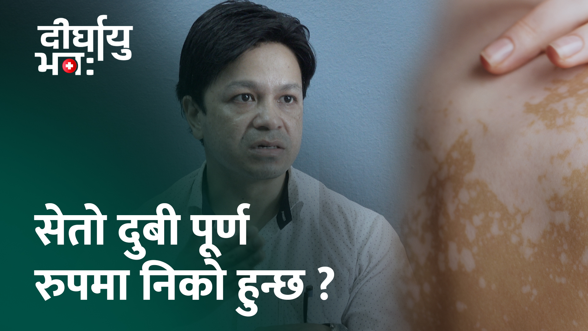 ‘सेतो दुबी हुने व्यक्तिले शरीरमा चोटपटक लाग्न दिनु हुँदैन’ (दिर्घायु भवः)