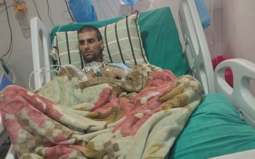 जेन–जी आन्दोलनका घाइते भन्छन् : घाउले भन्दा बढी चहर्‍याउँछ चाडबाडको सम्झनाले