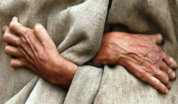 सुदूरपश्चिममा घटेन कुष्ठरोगको समस्या 