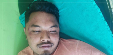 नेविसंघको आक्रमणमा अनेरास्ववियुका नेता देवराज घाइते 