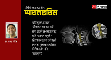 घाँटीको नसा च्यापिएर हुने प्यारालाइसिसकाे निदान के ? यी हुन् लक्षण