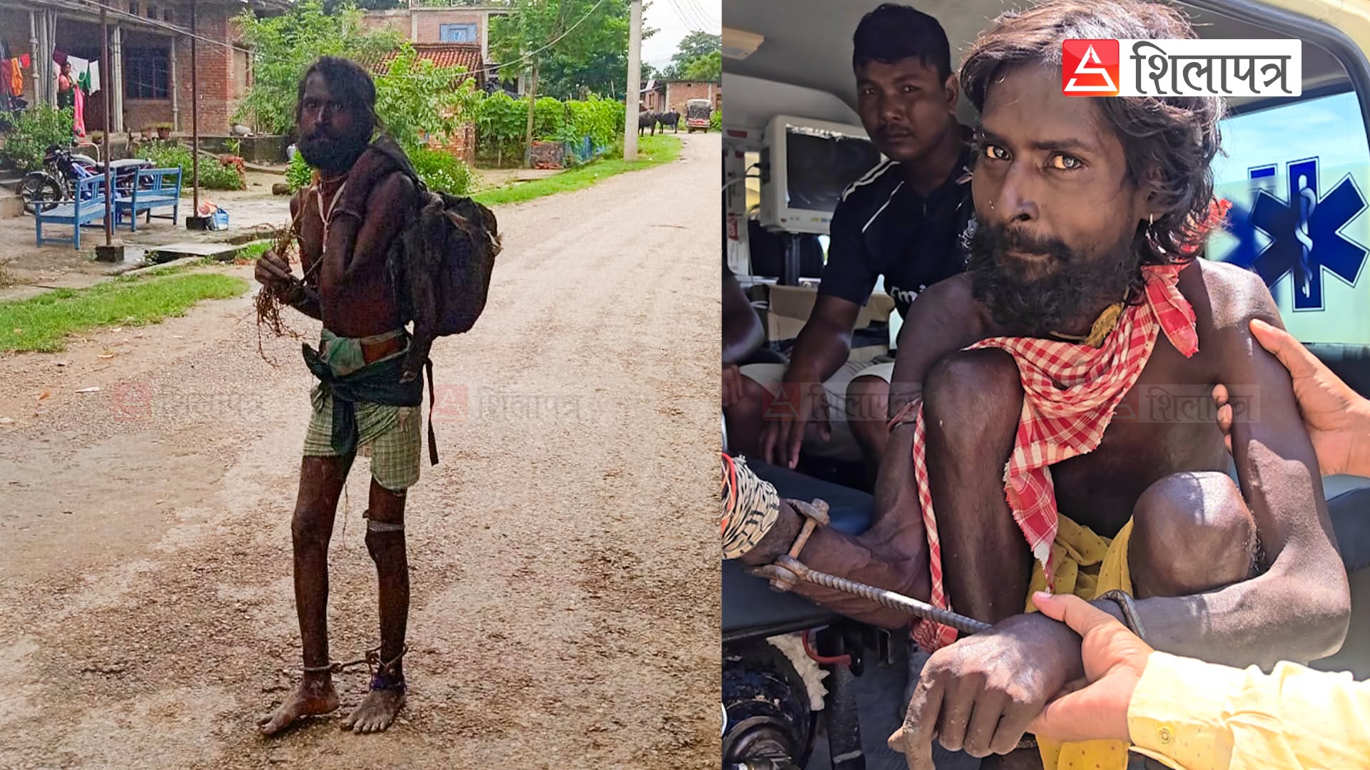 १० वर्षसम्म घरमै फलामे साङ्लोमा बाँधिएका ओमप्रकाशको कहालीलाग्दो कथा [भिडियाेसहित]