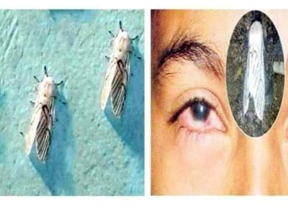 गुल्मीमा फैलिएको डरलाग्दो रोग सापु के हो ?