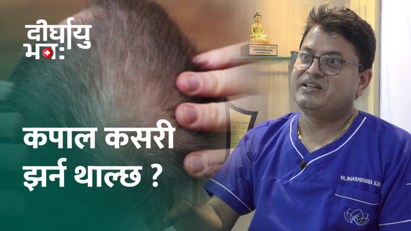 के हो कपाल झर्ने ‘एलोपेसिया एरियाटा’ समस्या ?