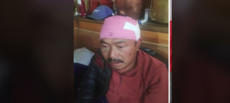 मनाङमा एमाले र कांग्रेसबीच झडप, कांग्रेस उम्मेदवार गुरुङ घाइते