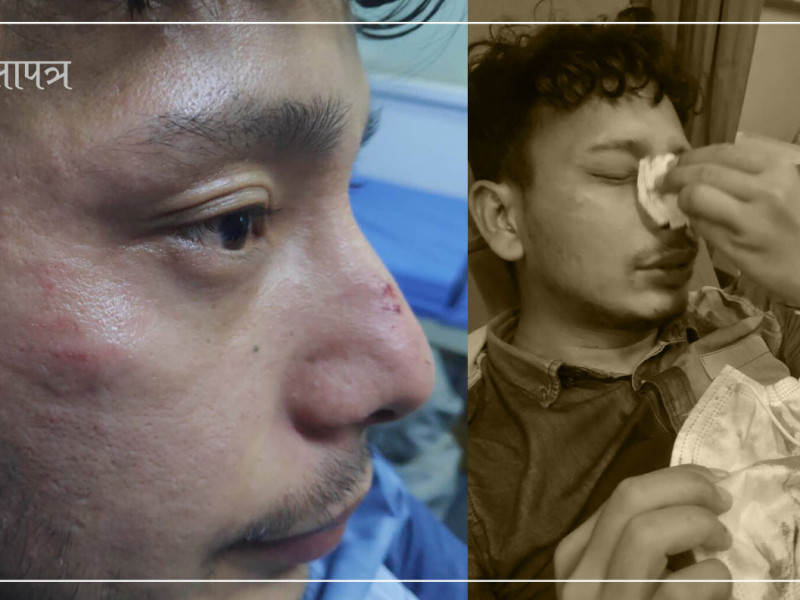 ललितपुरमा डाक्टर कुट्ने ट्राफिक प्रहरी जवान निलम्बन, असईसहित पाँच जना बग्गीखाना तानिए 