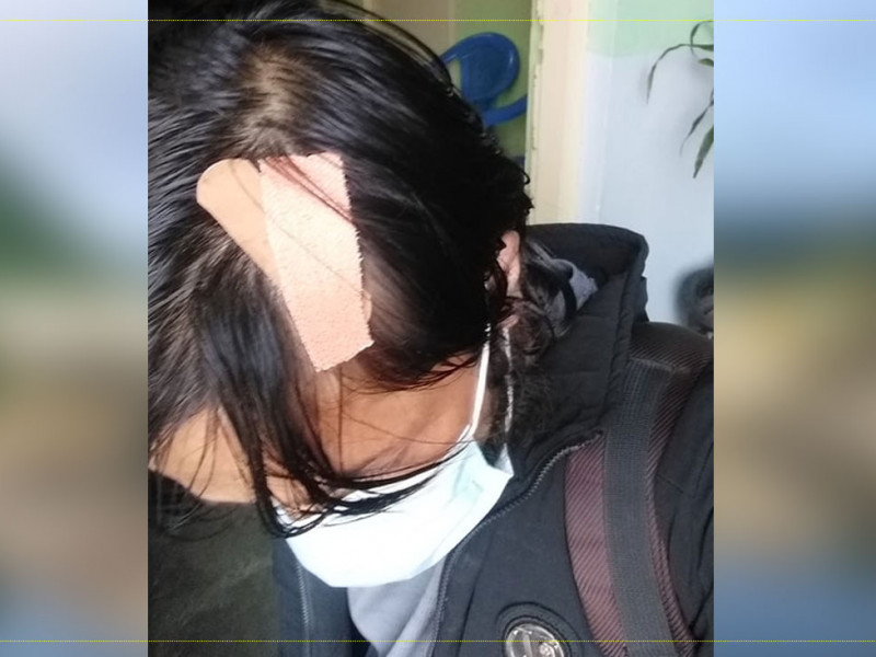 विद्यार्थीकाे कुटाइबाट घाइते शिक्षक भन्छन्- टाउकाेमा सात टाँका छन्, पेनकिलर खाँदैछु