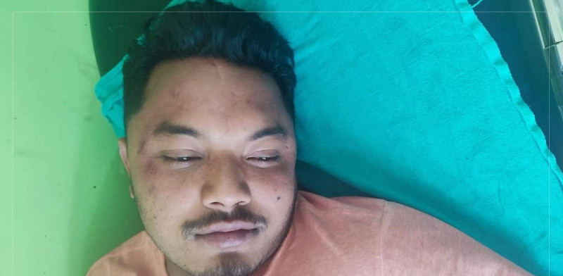 नेविसंघको आक्रमणमा अनेरास्ववियुका नेता देवराज घाइते 