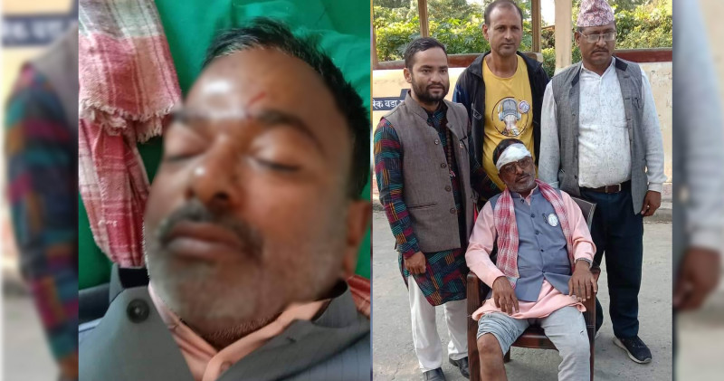 मोटरसाइकल दुर्घटना हुँदा प्रदेशसभाका उम्मेदवार घाइते, उपचार हुँदै