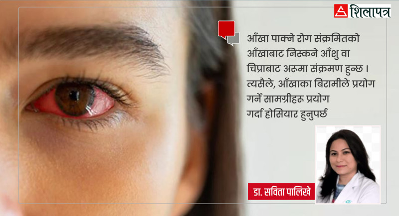 आँखा पाक्ने रोगबारे यसाे भन्छिन् वरिष्ठ आँखा रोग विशेषज्ञ डा. सविता पालिखे
