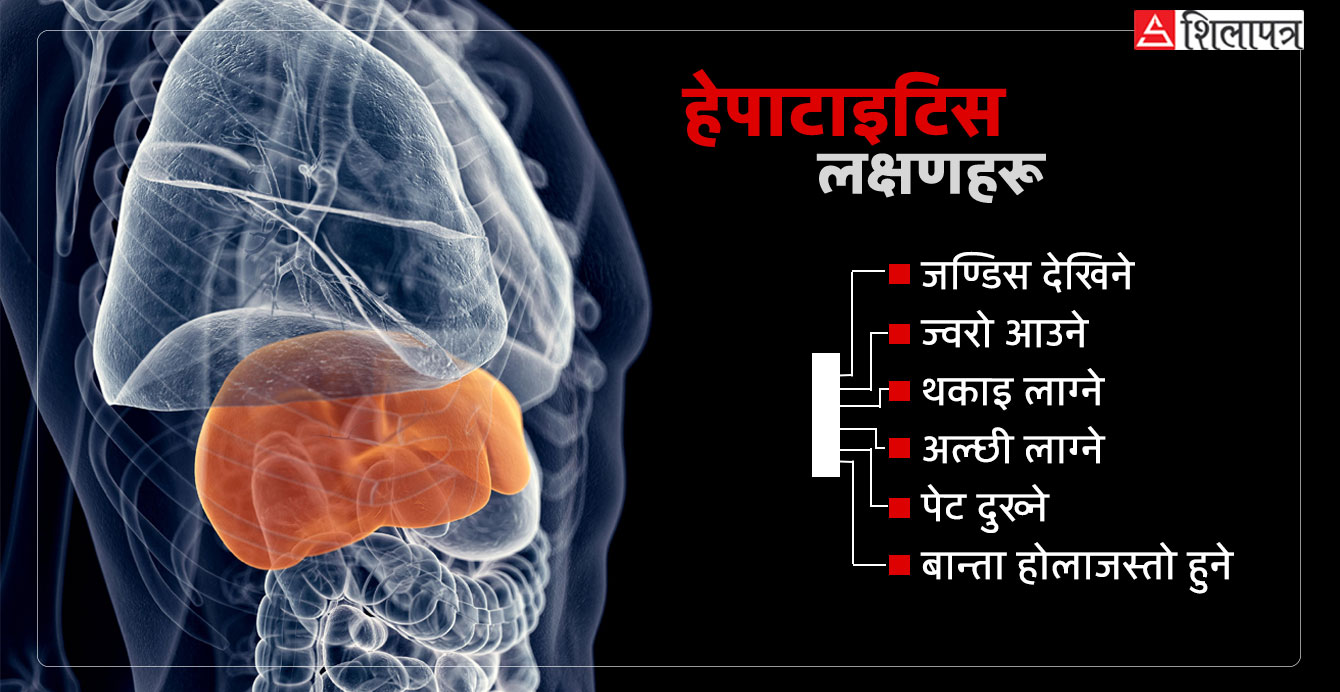 हेपाटाइटिसबाट कसरी बच्ने ? के याे राेग आफैँ निकाे हुन्छ ?