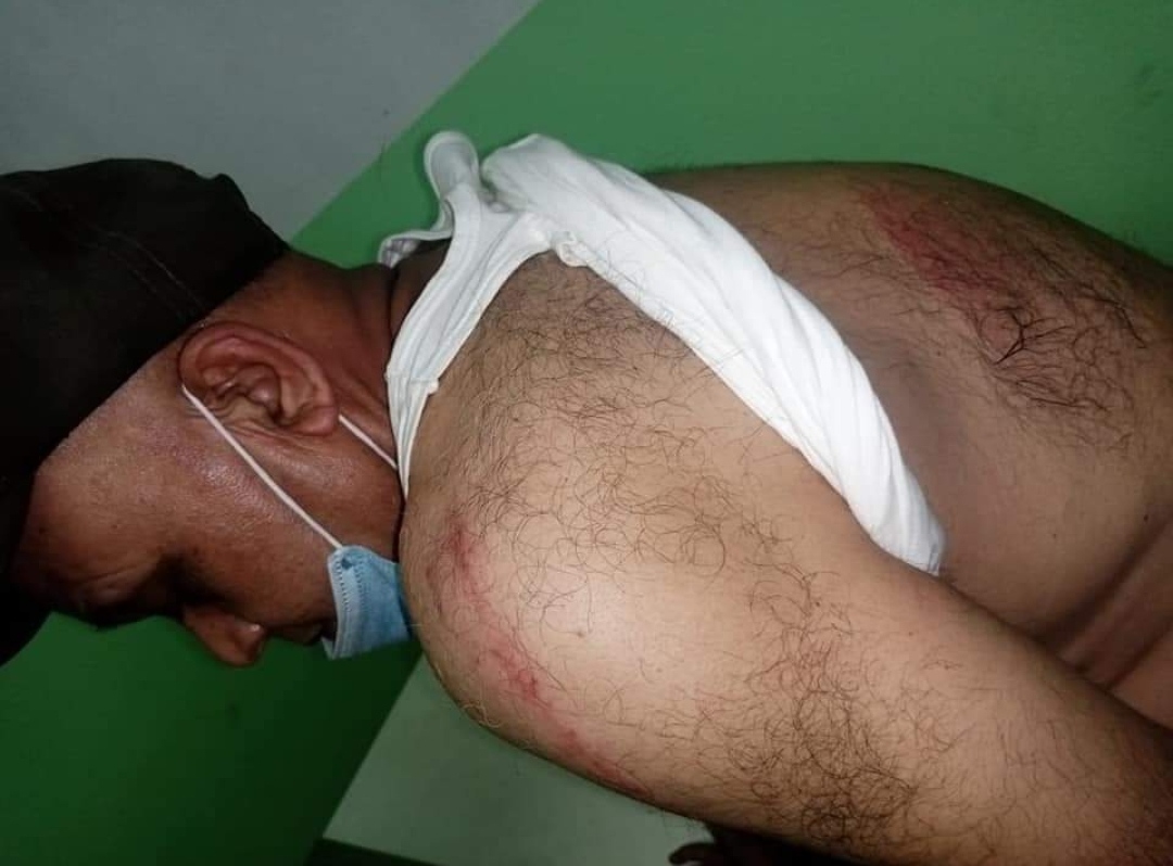 जसपा नेता अधिकारीमाथि मध्यरातमा कसले गर्‍याे आक्रमण ?