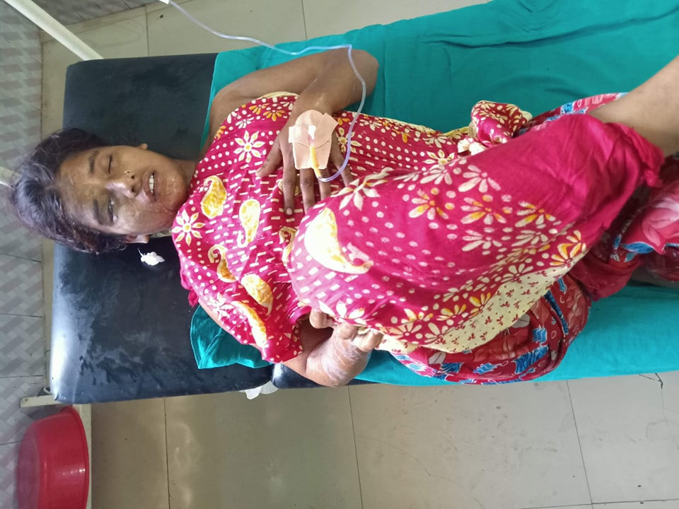 जनकपुरमा घरमै बसिरहेकी महिलामाथि एसिड प्रहार