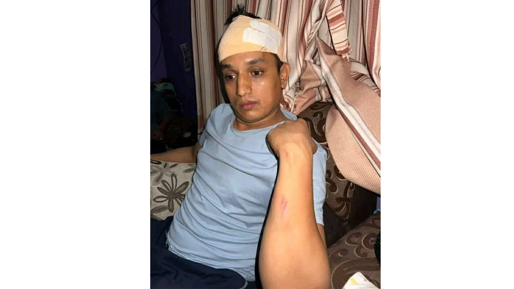 अज्ञात समूहबाट कुटिएका रास्वपा नेता भण्डारीको टाउकोमा १० वटा टाँका, आक्रमणकारी खोज्दै प्रहरी