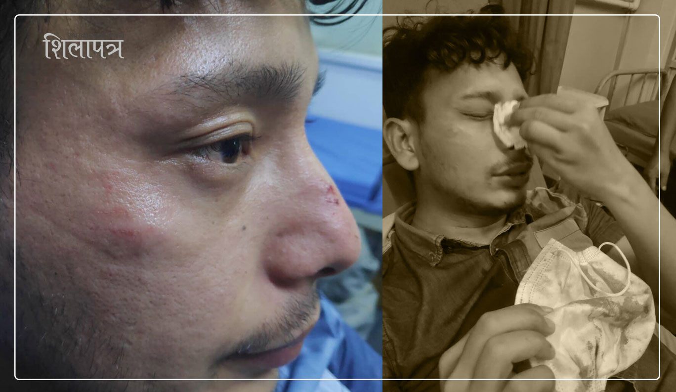 राति किन हिँडेकाे भन्दै प्रहरीले कुटे डाक्टर