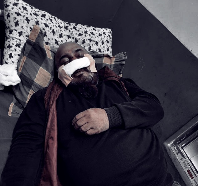 पाैडेल पक्षले अग्रता लिएपछि रुपन्देहीमा झडप, उम्मेदवारसहित पाँच जना घाइते
