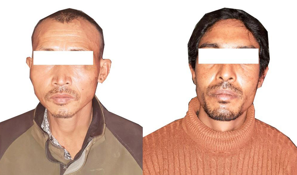 भक्तपुरमा घाँटी रेटेर महिलाकाे हत्या घटनामा दुई जना पक्राउ, याैन सम्बन्ध कारण